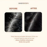 Makarizo Asters Scalp Therapy Massager