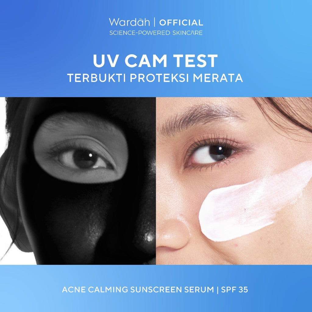 WARDAH UV Shield Acne Calming Sunscreen Moisturizer SPF 35 PA untuk komedo jerawat dan bekas jerawat kulit berminyak tekstur gel ringan mudah meresap Skincare