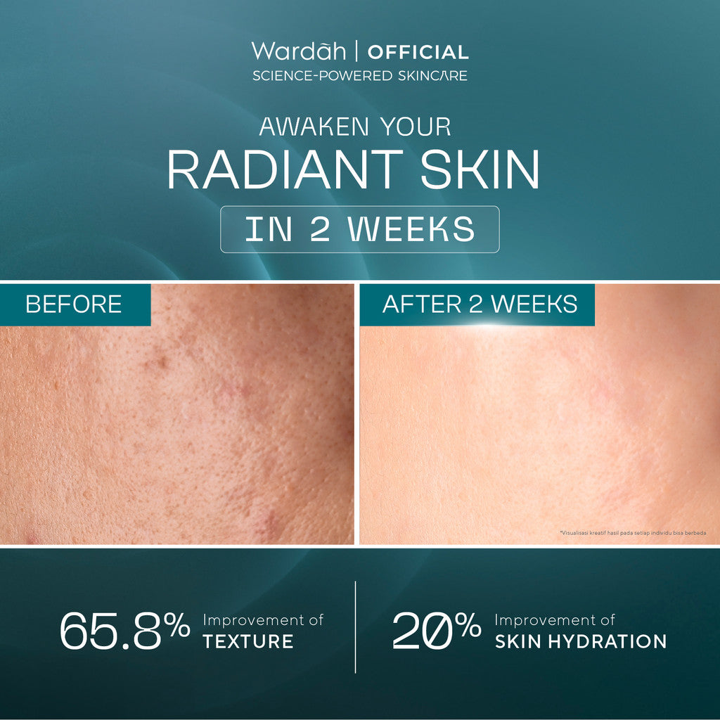 [SASHFIR PICKS!] Wardah Radiant Resurfacing Retinal Cysteamine Serum 30 ml - Serum Pencerah, Penghilang Kerutan, Retinol, Laser Effect, Renewal, Peeling - Skincare