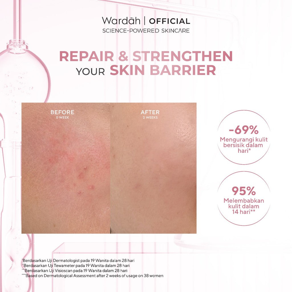 WARDAH Hydra Rose 14X Hyaluronic Pentavitin Deep Barrier Repair Serum 30 ml - Serum dengan Allantoin - Perawatan Wajah untuk Kulit - Resilient Skin - Skincare