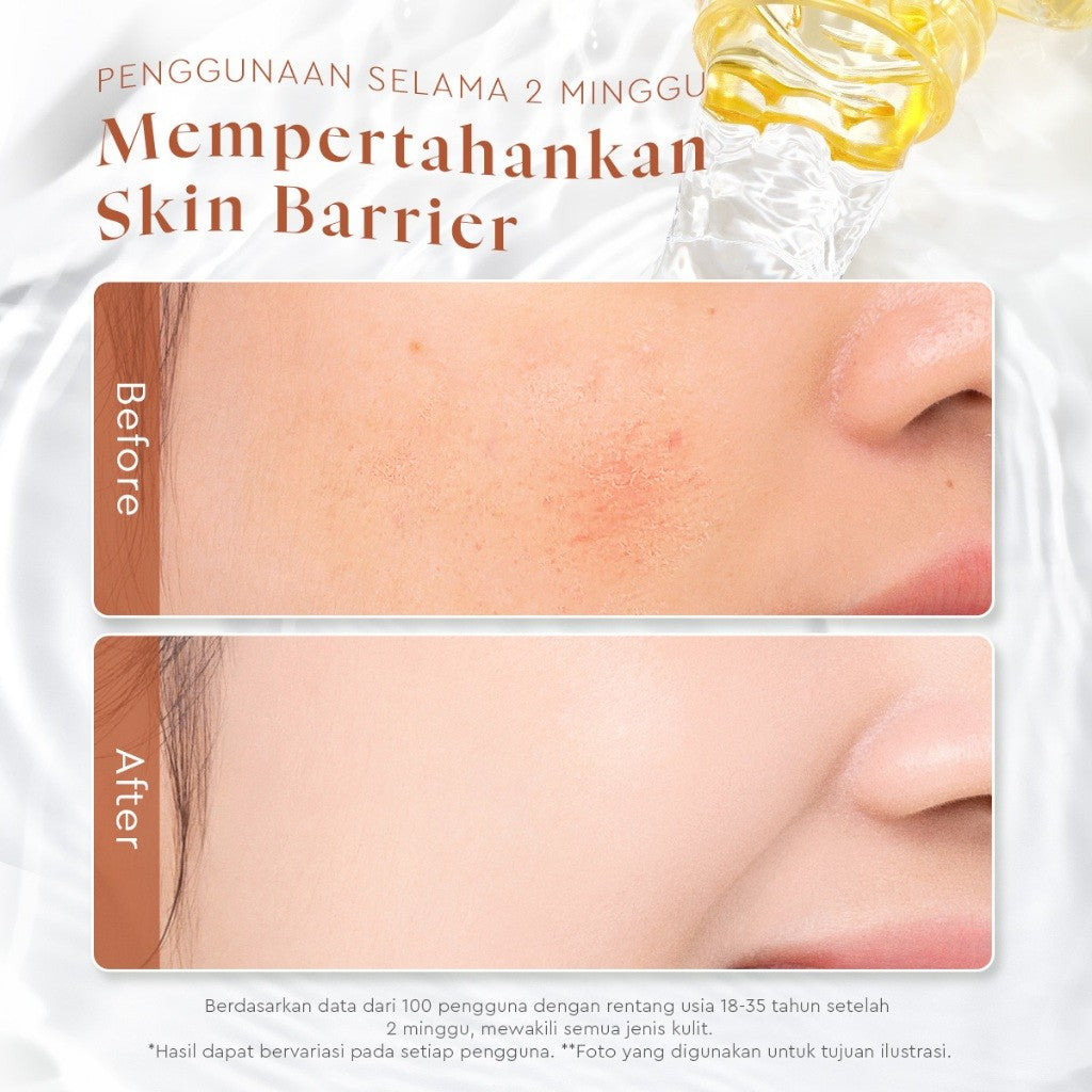 [KHUSUS MEMBER]Glad2Glow Propolis Hyaluronic Acid Barrier Essence Toner badan face mist hydrating toner centella Toner eksfoliasi wajah glycocid acid glycolic acid Memperbaiki penghalang kulit Jaga kulit Anda G2G Toner g2glow official store