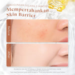 [KHUSUS MEMBER]Glad2Glow Propolis Hyaluronic Acid Barrier Essence Toner badan face mist hydrating toner centella Toner eksfoliasi wajah glycocid acid glycolic acid Memperbaiki penghalang kulit Jaga kulit Anda G2G Toner g2glow official store