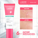 Labore AcnePro Biome Acne Spot Gel 15ml - Perawatan Wajah untuk Kulit Berjerawat dengan Kandungan Salicylic Acid dan Retinol