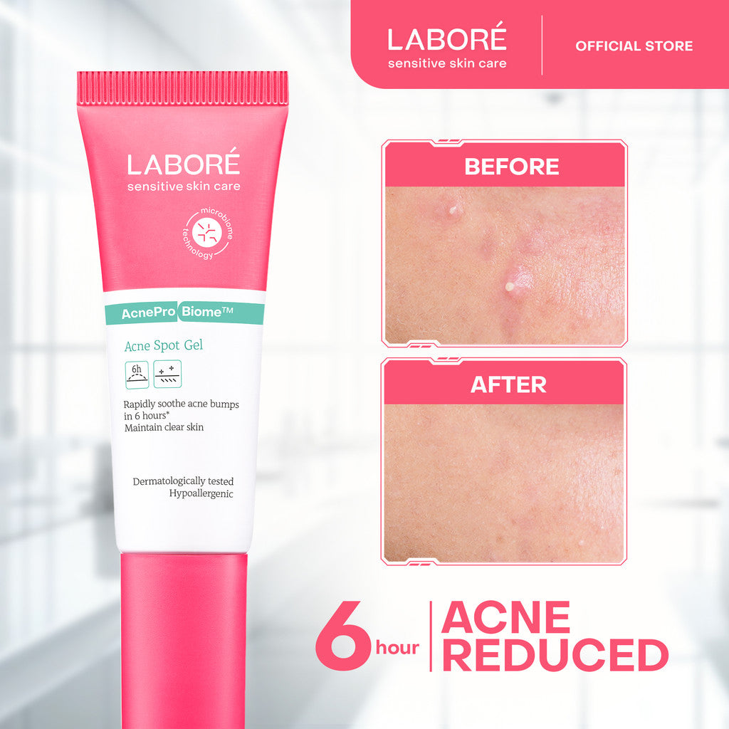 Labore AcnePro Biome Acne Spot Gel 15ml - Perawatan Wajah untuk Kulit Berjerawat dengan Kandungan Salicylic Acid dan Retinol