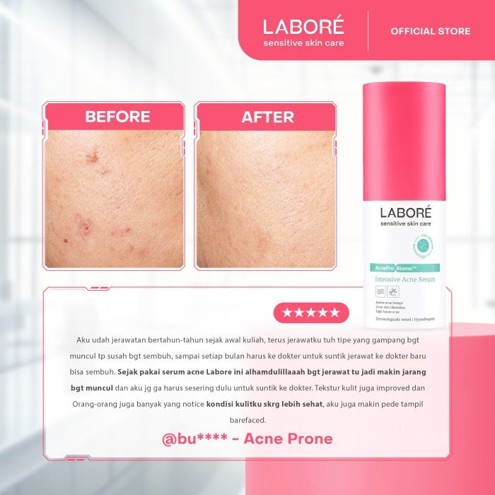 Labore AcnePro Biome Intensive Acne Serum 7ml 20ml - Serum Intensif Kulit untuk Mengatasi Permasalahan Kulit Berjerawat