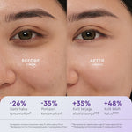 WARDAH Renew You 1% Retinol Microcapsule Ceramide Cell Renewal Serum