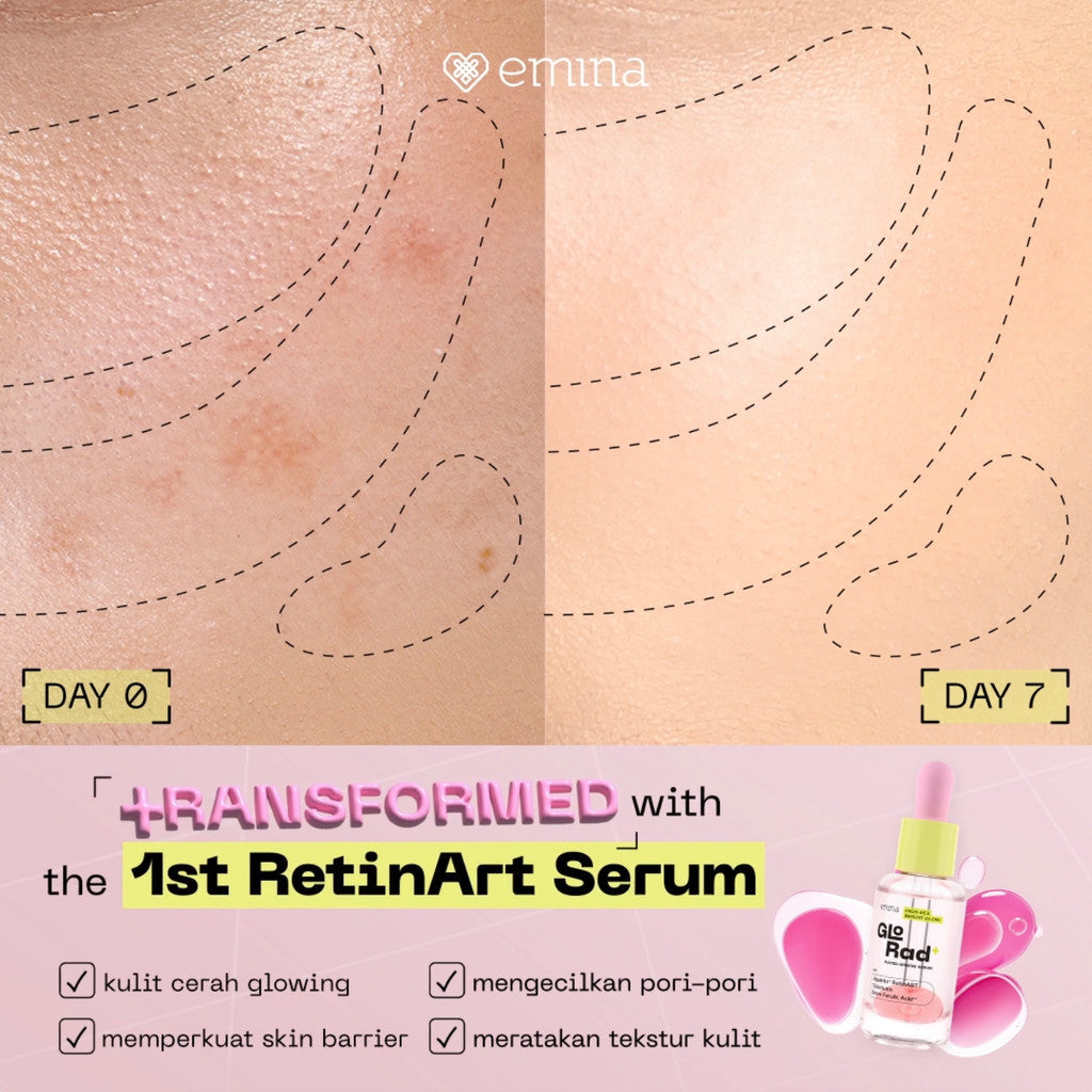 Emina GloRad+ High-Res Bright Glow Water-Sphere Serum - Serum Cerah Glowing Samarkan Dark Spot, dan Hempas Kulit Kusam