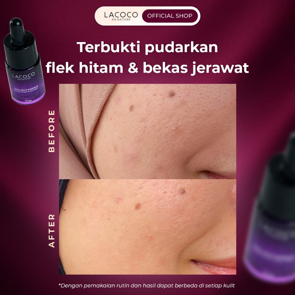 [AVO LOCAL POWER] Radiance Revival Kit (Oasea Marine Algae Revitalize Bouncing Moisturizer + Avoskin PHTE 30ml + Lacoco Darkspot Essence)