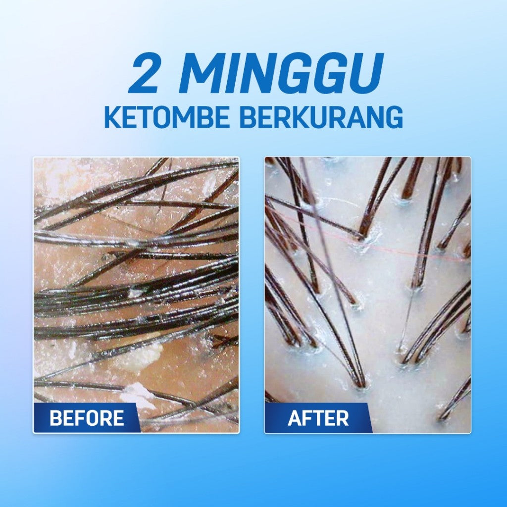 Erhair Combo Scalp and Hair Defense