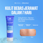 [SPECIAL 11.11] Emina Face Wash All Series - Niacinamide Oxy Ceramide Brightening Face Wash, Emina Prebiotic Tranexamic Acid Brightening, Ms Pimple Acne Solution, Oat Amino Low pH Cleanser