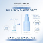 WARDAH Lightening 5% Niacinamide Serum Ampoule - Dengan 10X Advanced Niacinamide + Bisabolol dan 0% Alkohol - Mencerahkan Kulit Kusam, Bekas Jerawat, Belang Tidak Merata, Mencegah Hiperpigmentasi - Bright, Glow, White - Semua Jenis Kulit - Skincare