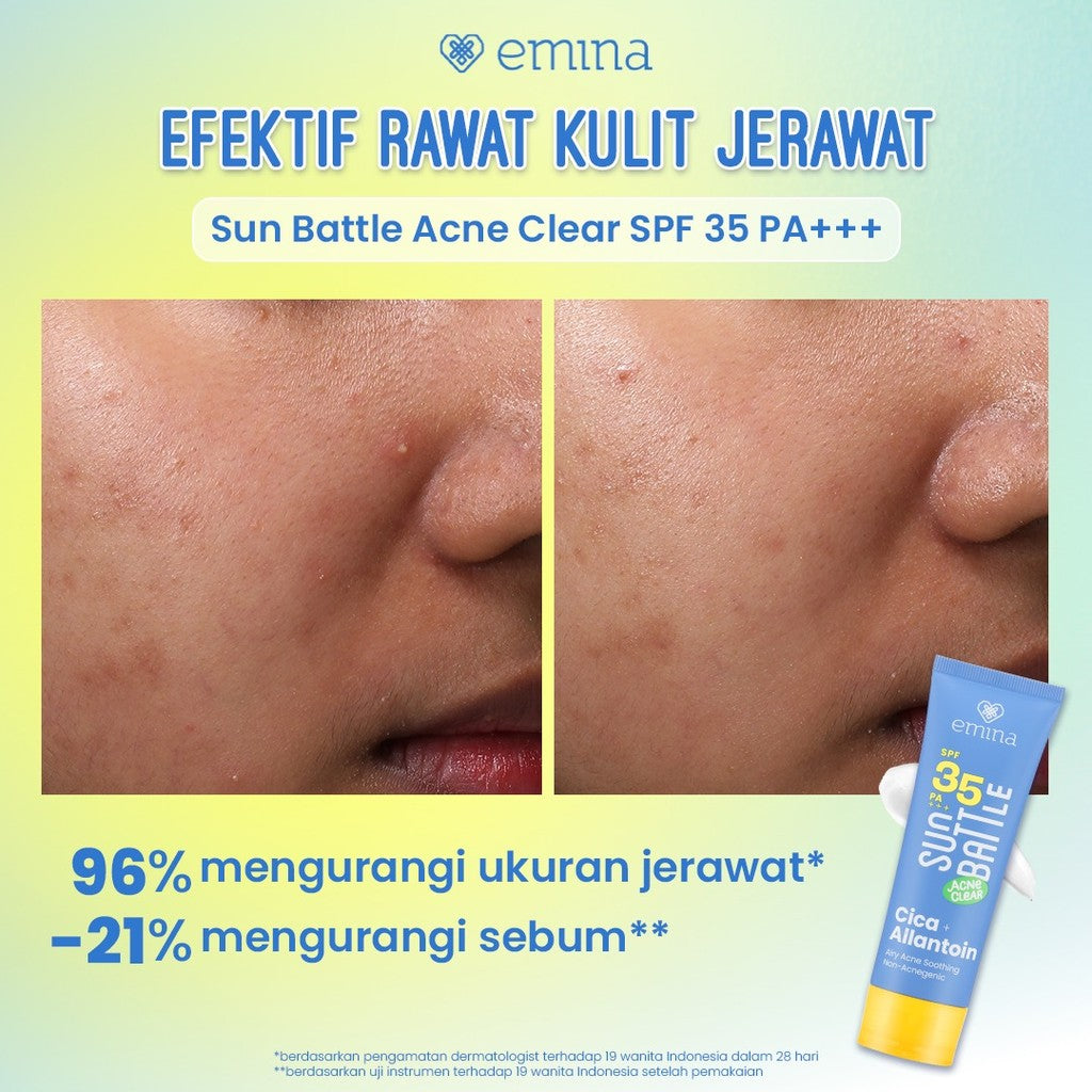 [SPECIAL 11.11] NEW! Emina Sun Battle SPF 35 PA +++ Acne Clear Cica + Allantoin Airy Acne Soothing 50 ml - Sunscreen untuk Melindungi dari sinar UV untuk Kulit Berminyak, Berjerawat, Sensitif. Ringan, no whitecast, fresh. Teruji in-vivo non-acnegenic
