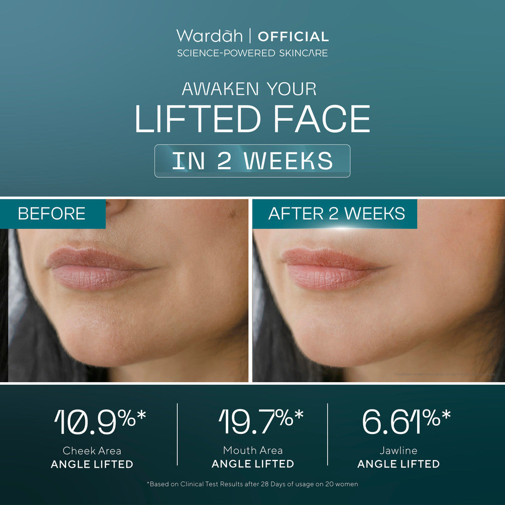 [TASYA FARASYA APPROVED!] Wardah EXOSOME + PDRN Lift Regenerating Serum (Clinic Treatment Serum dengan Salmon DNA & Hifu Result, Glowing, Plumpy, Collagen Serum) - Skincare