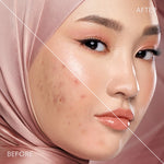 Instaperfect Realskin Filter Glow - Blurring & High Coverage- Instaperfect Skin Blur Filter Powder + Instaperfect Skin Glow Mesh Cushion- Paket Make Up Blurring Wajah
