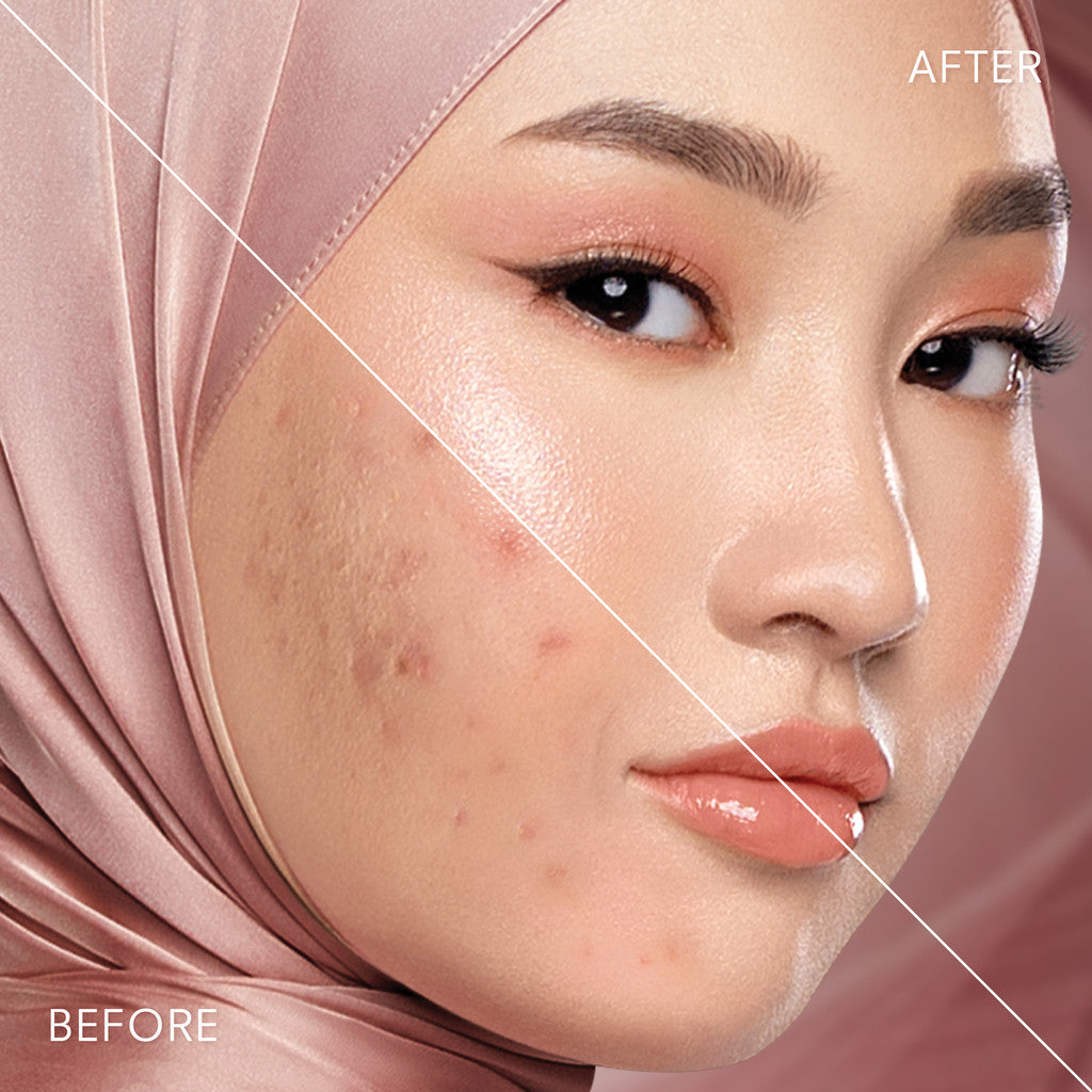 Instaperfect Realskin Filter Glow - Blurring & High Coverage- Instaperfect Skin Blur Filter Powder + Instaperfect Skin Glow Mesh Cushion- Paket Make Up Blurring Wajah