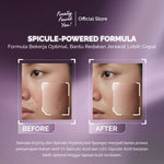 Finally Found You! Acne ProtecTea Spot Treatment 12g | Obat Totol Jerawat Untuk Kulit Sensitif & Berjerawat