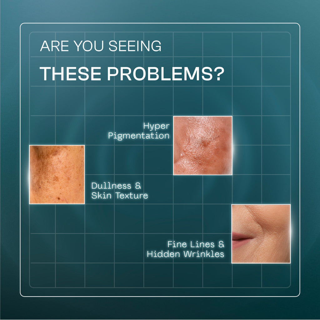 [Wardah Exclusive Member] Wardah Radiant Resurfacing Retinal Cysteamine Serum 30 ml - Serum Pencerah, Penghilang Kerutan, Retinol, Laser Effect, Renewal, Peeling - Skincare