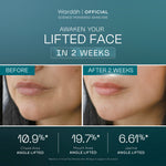 [Wardah Exclusive Member] Wardah EXOSOME + PDRN Lift Regenerating Serum (Clinic Treatment Serum dengan Salmon DNA & Hifu Result, Glowing, Plumpy, Collagen Serum) - Skincare