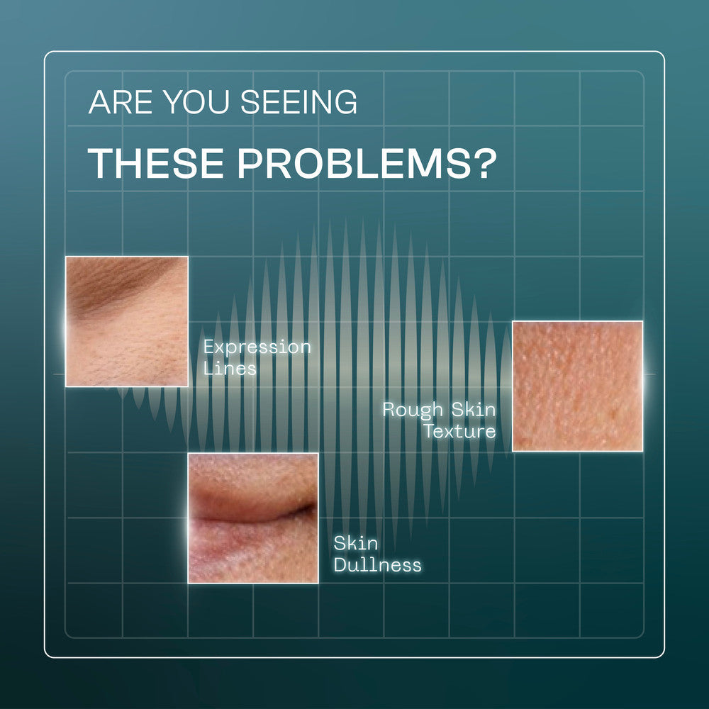 [Wardah Exclusive Member] Wardah EXOSOME + PDRN Lift Regenerating Serum (Clinic Treatment Serum dengan Salmon DNA & Hifu Result, Glowing, Plumpy, Collagen Serum) - Skincare