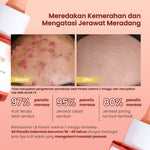 [Twin Pack] GLOW FX Acne Pure Serum - Serum Jerawat Meradang dan Hempas Jerawat Batu Tanpa Bekas