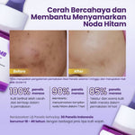 [Clear & Bright Perfecting Trio] GLOW FX Peeling Serum + Glow Bomb Serum 20ml + Acne Pure Serum 20ml