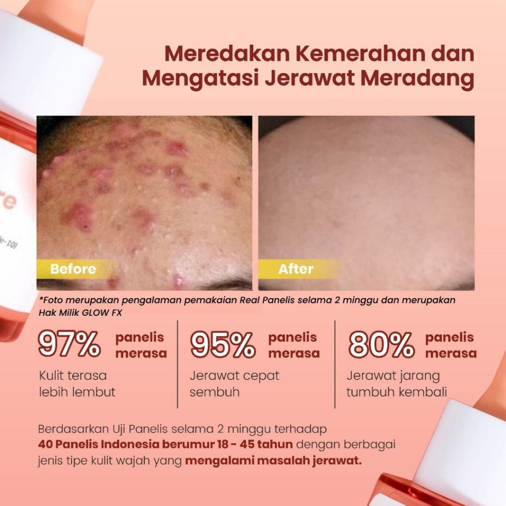 [Clear Skin Set] GLOW FX Glow Bomb Serum 20ml 19% Brightening Power + Brightening Acne Pure Serum