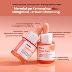 [Twin Pack] GLOW FX Acne Pure Serum - Serum Jerawat Meradang dan Hempas Jerawat Batu Tanpa Bekas