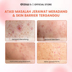 GLOW FX Clear Skin & Glow Complete 4 Step Bundle - Skincare Lengkap Jerawat & Brightening 4 Langkah