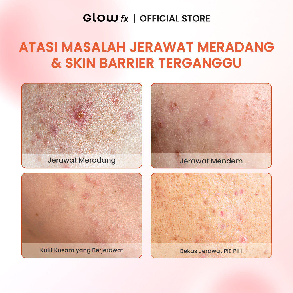 GLOW FX Clear Skin & Glow Complete 4 Step Bundle - Skincare Lengkap Jerawat & Brightening 4 Langkah