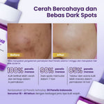 GLOW FX Bundle Set 2pcs Acne Pure Serum 20ml + 1pcs Glow Bomb Serum 20ml