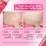 [Single Pack] GLOW FX 17% Total Acids CeraCapsule Peeling Solution Brightening Serum Exfoliasi Wajah