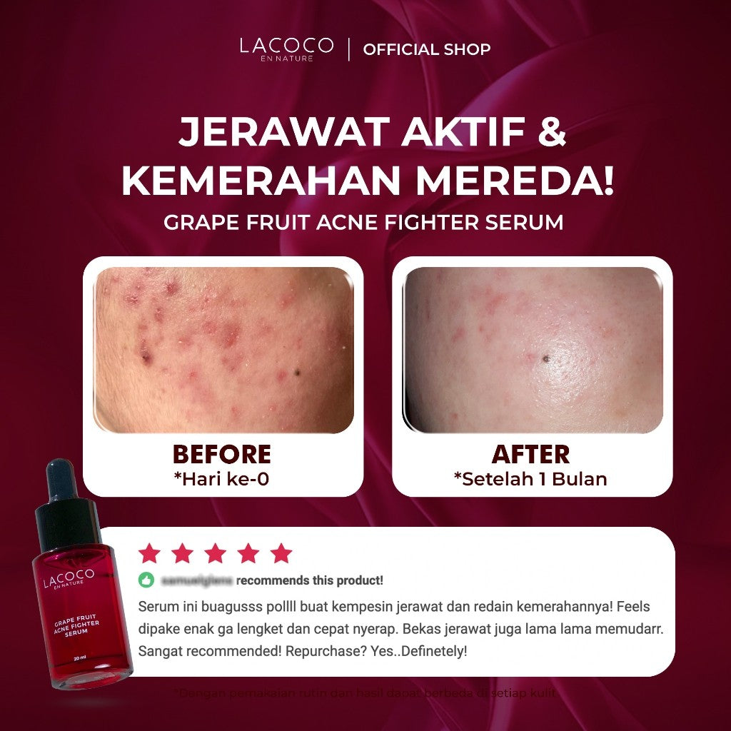 [BEST SELLING] [Abel Cantika's Picks] Lacoco Grape Fruit Acne Fighter Serum Skincare Jerawat Meradang Beruntusan Glow Swiss Glad Skint