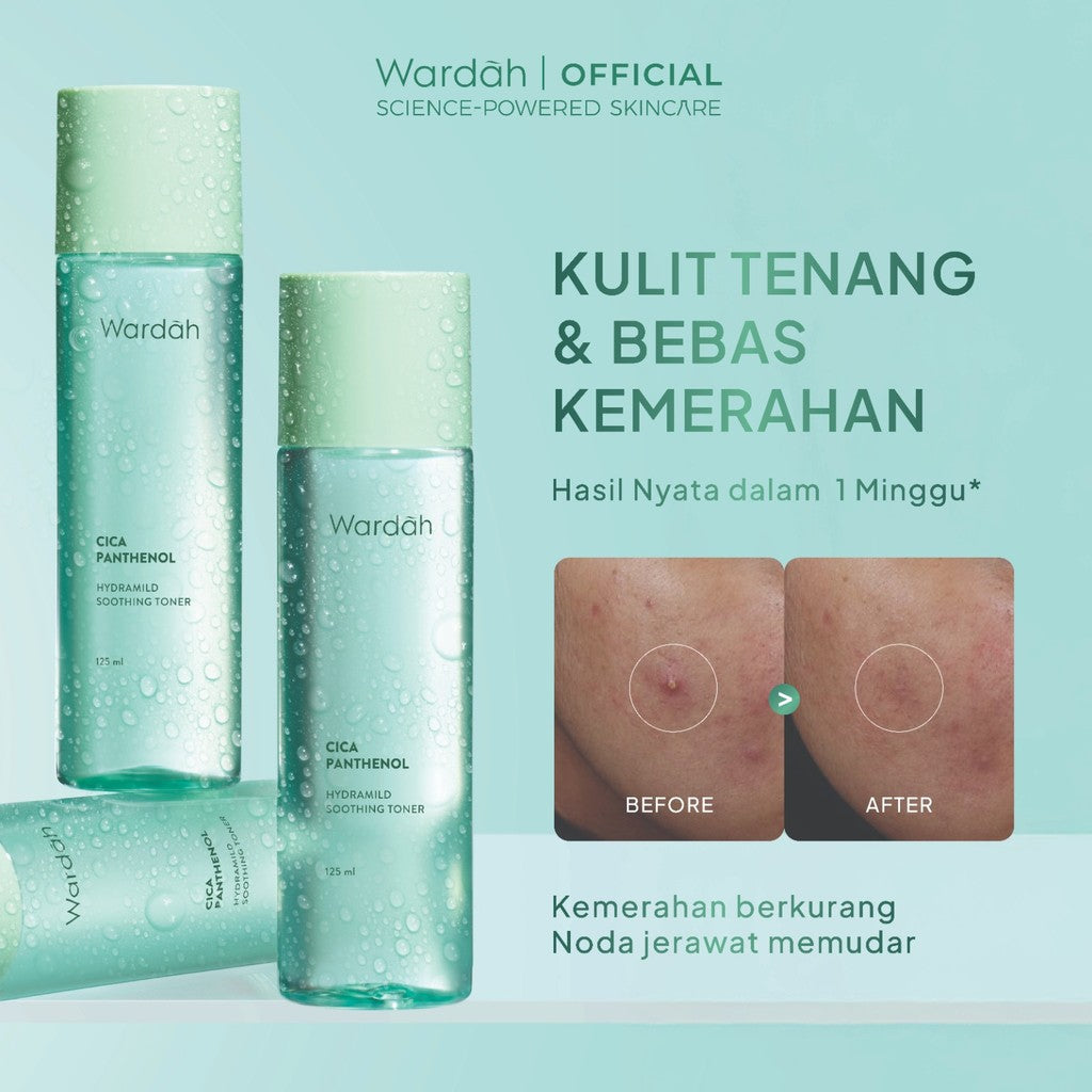 NEW! Wardah Cica Complex Panthenol Hydramild Soothing Toner 125 ml Hydrasoothe Formula Toner Wajah Facial Memudarkan Bekas Jerawat - Toner Badan - Skincare
