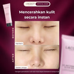 Lacoco Acne Free Combo (Watermelon Glow Mask, Grape Fruit Acne Fighter Serum, Ultimate Golden Swallow)