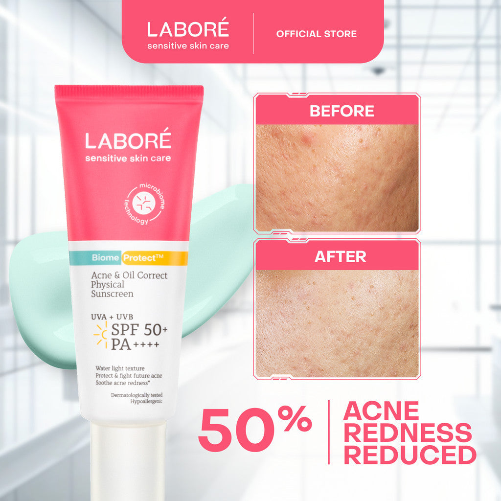 Labore Skin Defense Duo for Normal / Acne Prone Skin -   Mild Cleanser 225 ml |   Physical Sunscreen 30 ml |   Acne & Oil Correct Sunscreen 40 ml - Pembersih Wajah - Lembut - Cocok untuk Kulit Sensitif - Melembabkan -Sunscreen - Tabir Surya