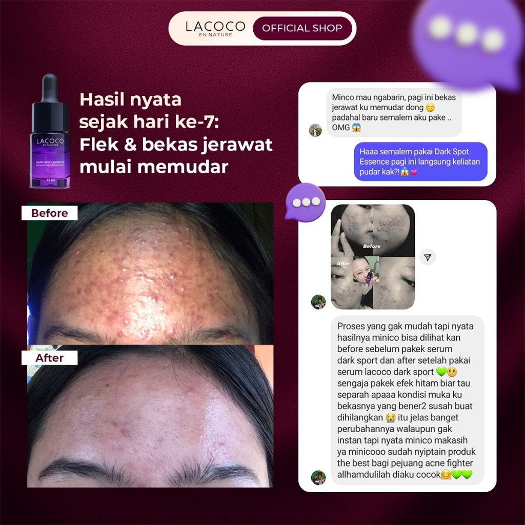 [BEST SELLING] Lacoco Dark Spot Essence Serum Penyamar Flek Hitam Noda Bekas Jerawat Tranexamic Acid Finally Something Glad True Skint