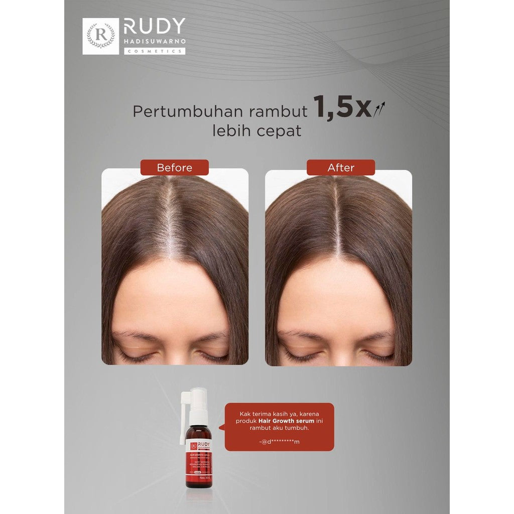 [BUNDLE] Rudy Hadisuwarno Hairloss Warrior