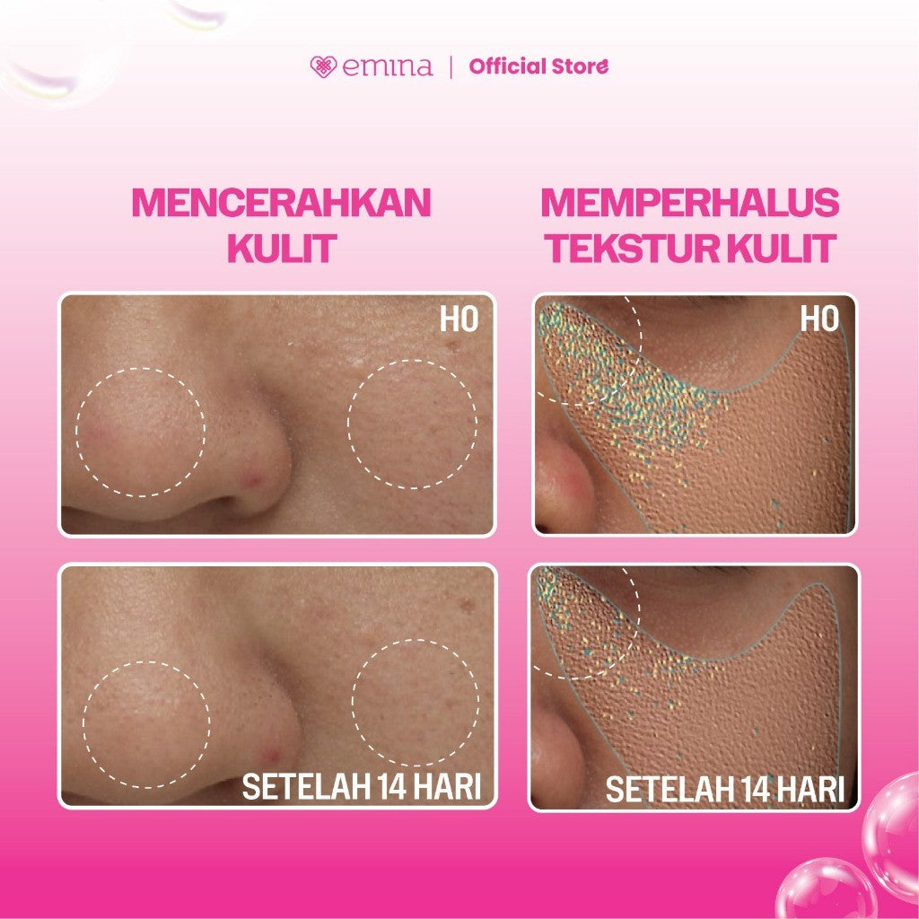 [SPECIAL 11.11] NEW! Emina Niacinamide Oxy Ceramide Brightening Face Wash 50ml 100ml - Sabun Muka Cerah, Glowing, Perbaiki Skin Barrier, Mengontrol Minyak Sebum, Lembab Tanpa Ketarik, Anti Kusam, Cocok untuk semua jenis kulit - Bright Stuff