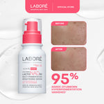 [Creator Picks] NEW! LABORE Multi-Pigmentation Brightening Serum - Serum Brightening Serum Pencerah Wajah Mengatasi Flek Hitam Bekas Jerawat Sun Spot Melasma Mencerahkan Kulit Kusam