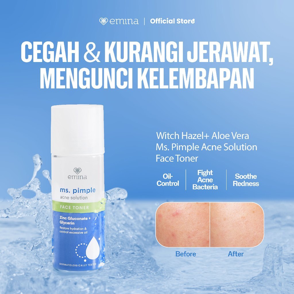 [BIG SALE] Emina Ms. Pimple Acne Solution Face Toner 100ml - Toner Wajah Melembabkan Kulit Berjerawat