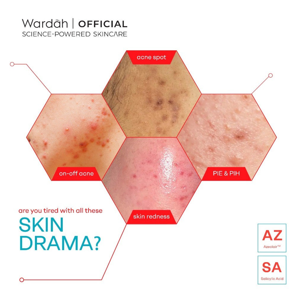 WARDAH Acne Serum Acnederm Relief Serum 20ml - melawan jerawat, cocok untuk Kulit Berjerawat, Komedo, menjaga skin barrier, sensitive - Skincare