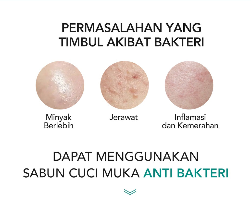 YOU Hy! Amino Bye-Byeteria Anti Bacterial Facial Wash Sabun Pembersih Wajah Hyaluronic Acid