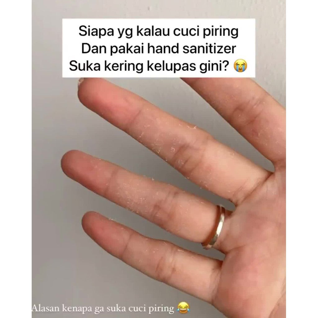 Viva Hand & Body Lotion – Moisturizing & Softening Formula | 100ml Travel Size